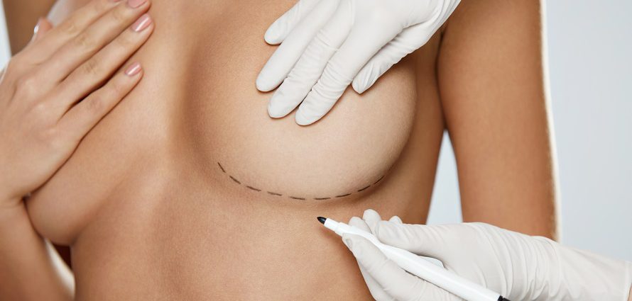 breast augmentation preparation marking the breasts for incision