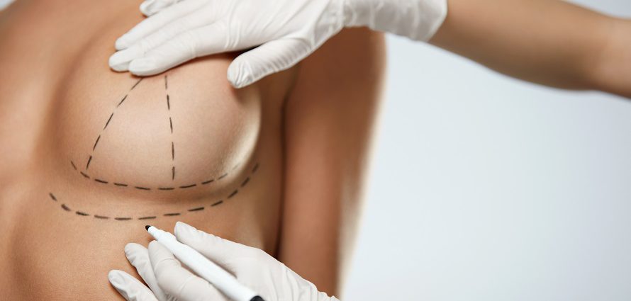 doctor marking patient breast for surgical incisions