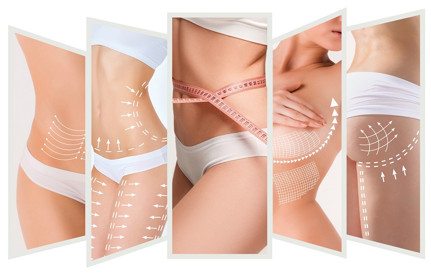 Body Lift Why A Body Lift Helps After Weight Loss Surgery