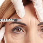 middle aged woman receiving botox injection to forehead