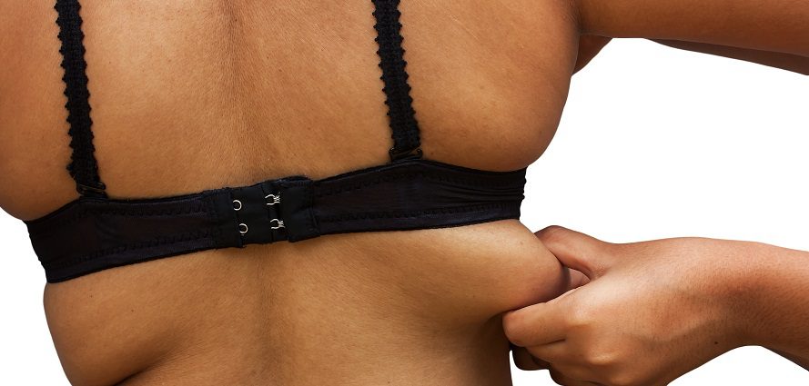 Bra Line Back Lift: Cost, Reviews, Before & After Los Angeles