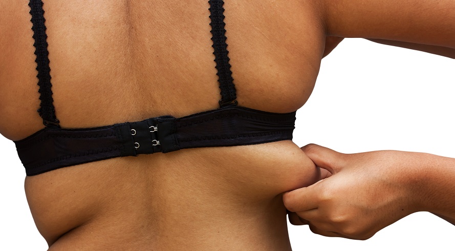 Back fat under bra deals