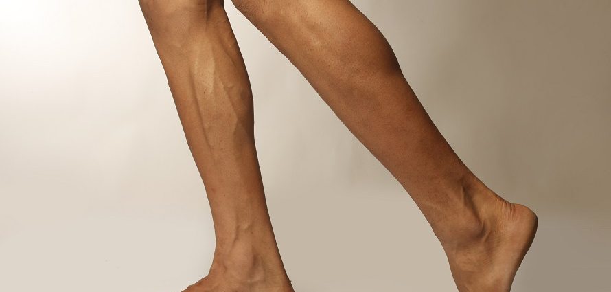 below the knee image of a man with small calf muscles