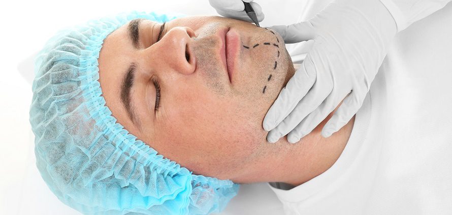 male chin surgery patient getting prepped for treatment