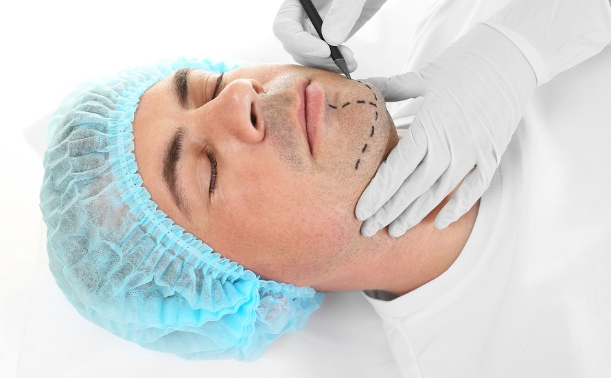 Chin Surgery: Genioplasty (Augmentation) and Mentoplasty (Reduction)