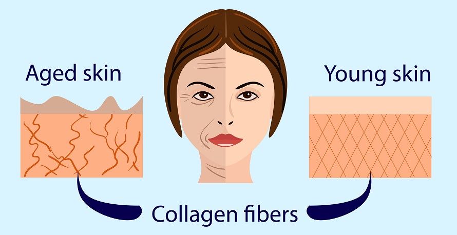 Collagen - How It Works - Injections Cost, Results & Side Effects