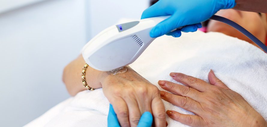 cosmetic hand rejuvenation treatment