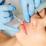 young female patient getting lip injections