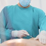 liposuction surgeon performing treatment