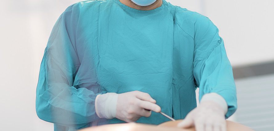 liposuction surgeon performing treatment