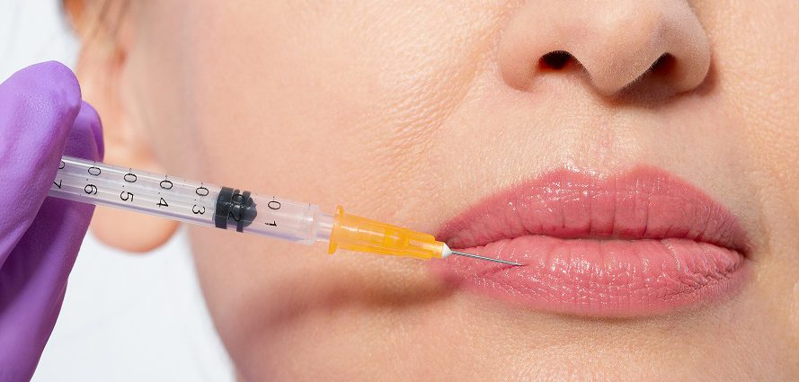 middle-aged woman receiving lip injections
