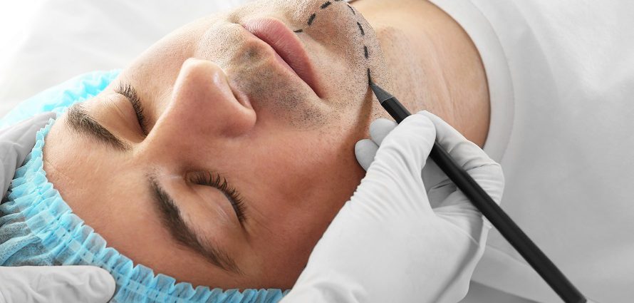 male patient getting prepped for cosmetic chin surgery