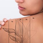 concept showing a shoulder tattoo removal over time