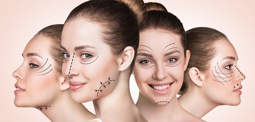 series of women with facial markup for different facelift variations